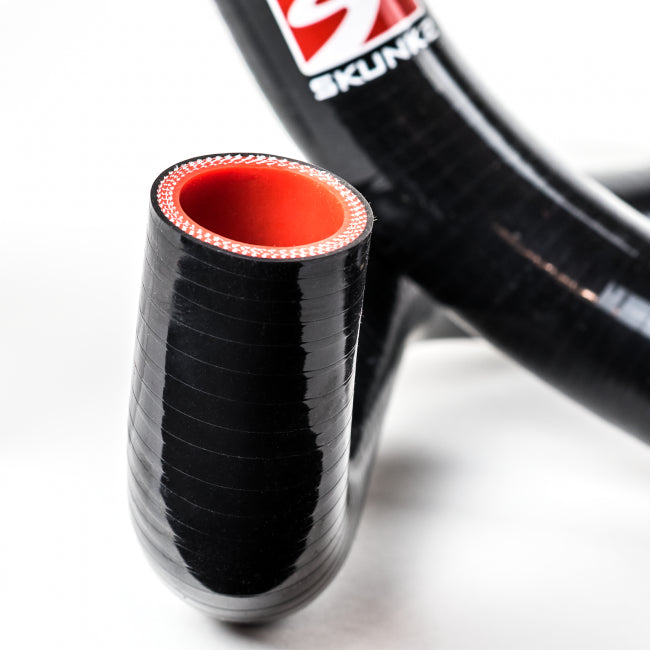 Radiator Hose Kit <br> 12-15 Honda Civic Si